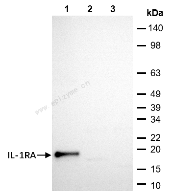 Anti-IL-1RA Mouse mAb [65K81R57]