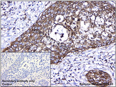 Anti-IL-1RA Mouse mAb [65K81R57]