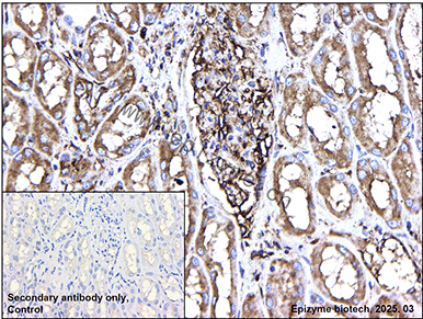 Anti-IL-1RA Mouse mAb [65K81R57]