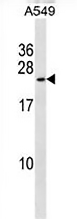 Anti-KCNMB1 Rabbit pAb