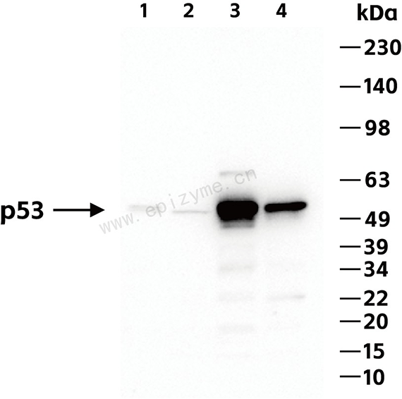 Anti-p53 Rabbit mAb [76K75K75]