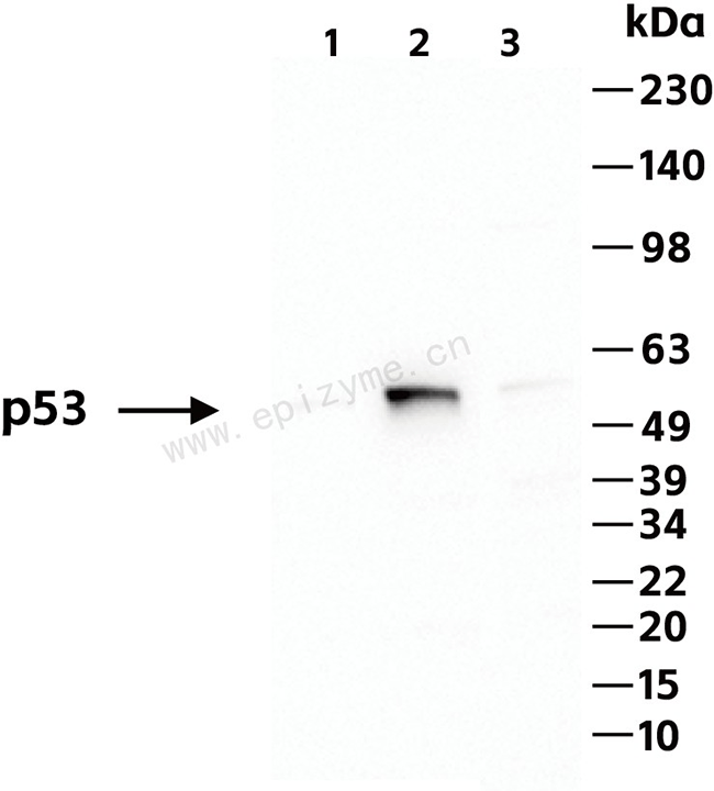Anti-p53 Rabbit mAb [76K75K75]