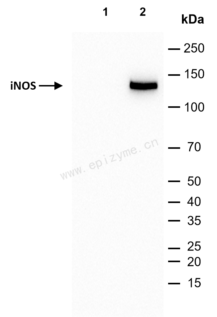 Anti-iNOS Rabbit mAb [29V01R82]