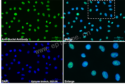 Anti-Nuclei Mouse mAb [84E15P56]