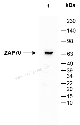 Anti-ZAP70 Rabbit mAb [99M85M65]