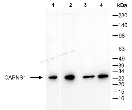 Anti-CAPNS1 Rabbit mAb [38H33K89]