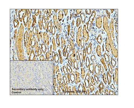 Anti-CAPNS1 Rabbit mAb [38H33K89]