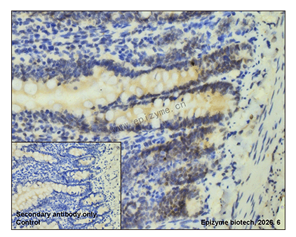 Anti-p53 Rabbit mAb [76K75K75]