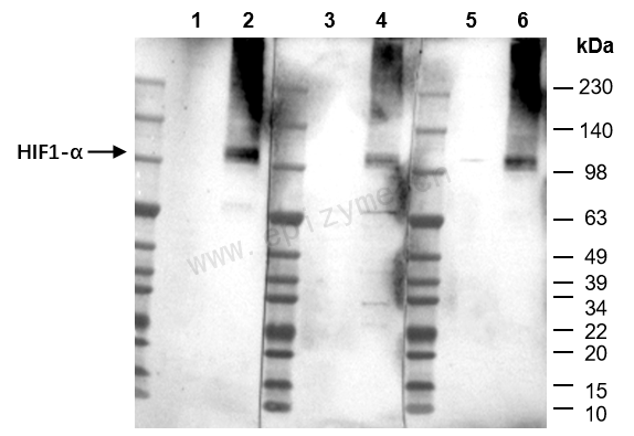 Anti-HIF-1 alpha Rabbit mAb [39H77C67]