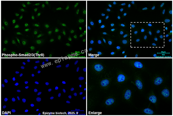 Anti-phospho-Smad2/3(Thr8) Mouse mAb [61A83P70]