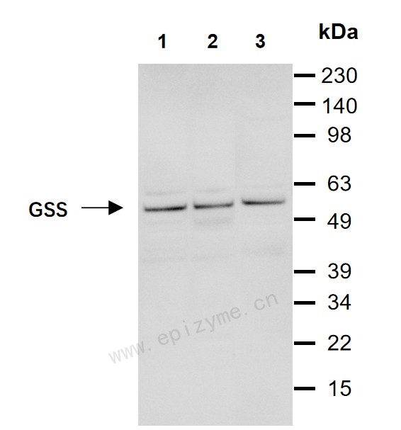 Anti-Glutathione Synthetase Mouse mAb [77M64C82]