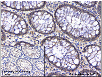 Anti-Glutathione Synthetase Mouse mAb [77M64C82]