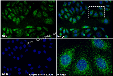 Anti-Glutathione Synthetase Mouse mAb [77M64C82]