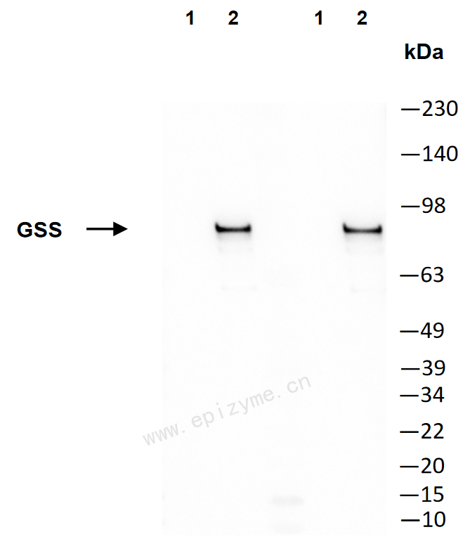 Anti-Glutathione Synthetase Mouse mAb [77M64C82]