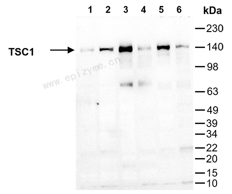 Anti-Hamartin Mouse mAb [28R23N59]
