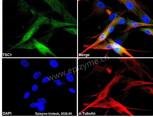 Anti-Hamartin Mouse mAb [28R23N59]