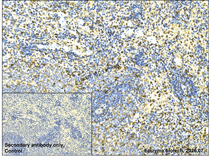 Anti-MKLP1 Rabbit mAb [93K15L94]
