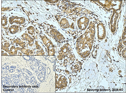 Anti-MKLP1 Rabbit mAb [93K15L94]