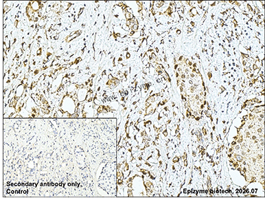 Anti-Max Dimerization Protein 3 Rabbit mAb [30K31K03]