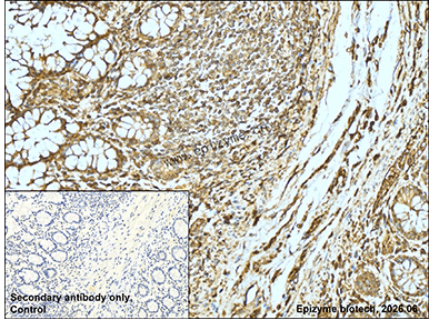 Anti-ADH5 Rabbit mAb [20K46L78]