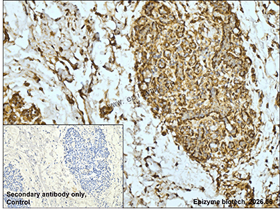 Anti-ADH5 Rabbit mAb [20K46L78]