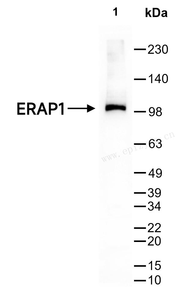 Anti-ERAP1/ARTS1 Rabbit mAb [28L04L76]