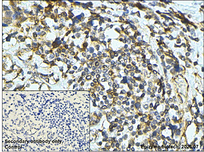 Anti-ERAP1 Rabbit mAb [28L04L76]