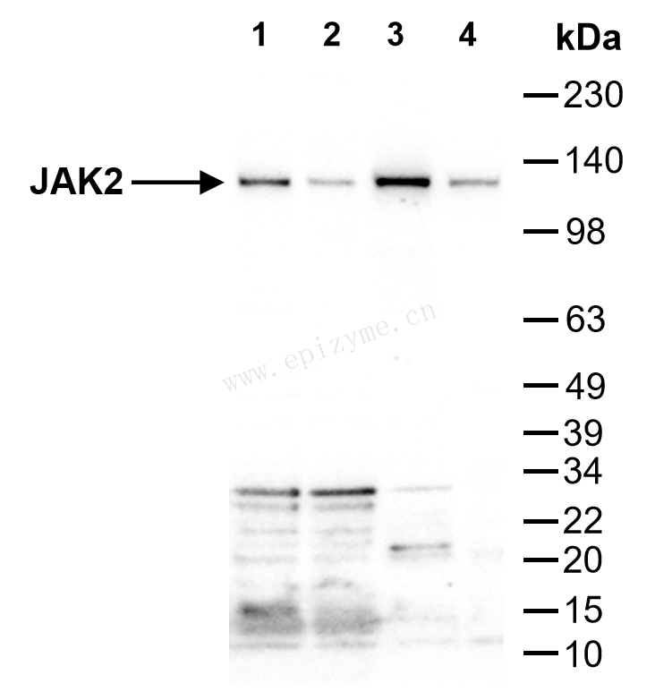 Anti-JAK2 Rabbit mAb [32M03M85]