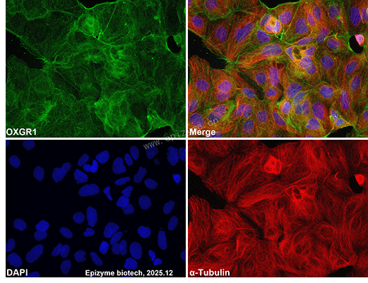 Anti-OXGR1 Rabbit mAb [97L00L11]