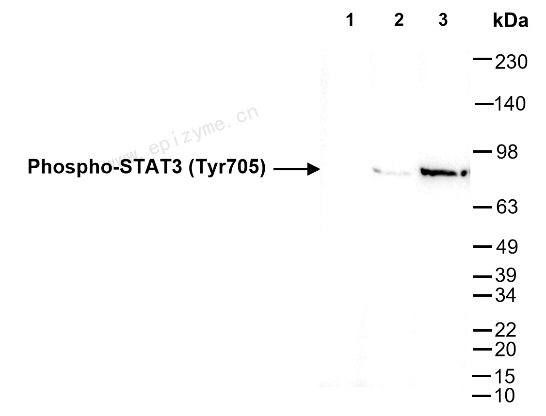 Anti-Phospho-STAT3 (Tyr705) Rabbit mAb [80M35B11]