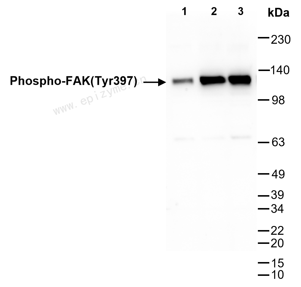 Anti-Phospho-FAK (Tyr397) Rabbit mAb [79E12A96]