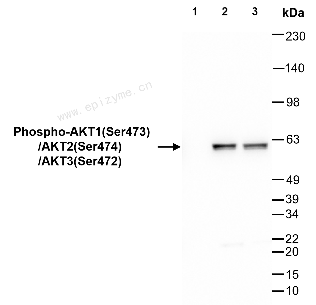 Anti-Phospho-AKT1 (Ser473)/AKT2 (Ser474)/AKT3 (Ser472) Rabbit mAb [30P57N10]