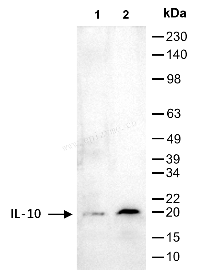 Anti-IL-10 Rabbit mAb [29H28B60]