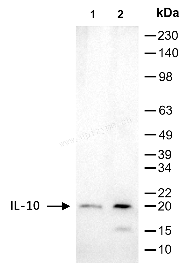 Anti-IL-10 Rabbit mAb [29H28B60]