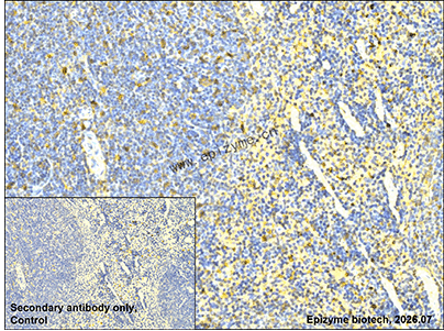 Anti-IL-10 Rabbit mAb [29H28B60]