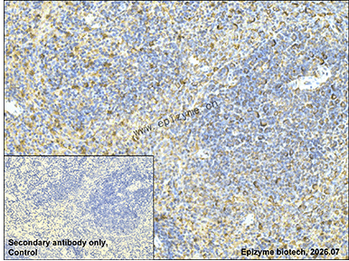 Anti-IL-10 Rabbit mAb [29H28B60]