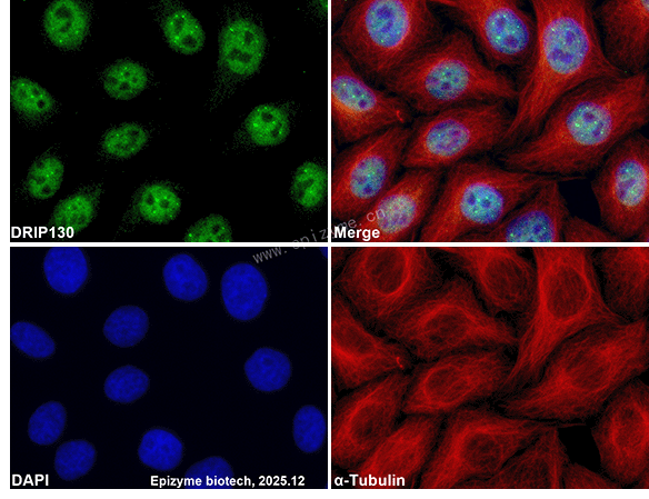 Anti-MED23/DRIP130 Rabbit mAb [29A37R18]