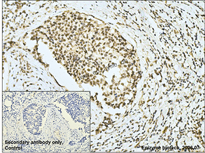 Anti-MED23/DRIP130 Rabbit mAb [29A37R18]