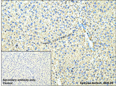 Anti-SEC14L2/TAP Rabbit mAb [77C40R62]
