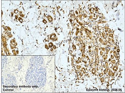 Anti-SEC14L2/TAP Rabbit mAb [77C40R62]