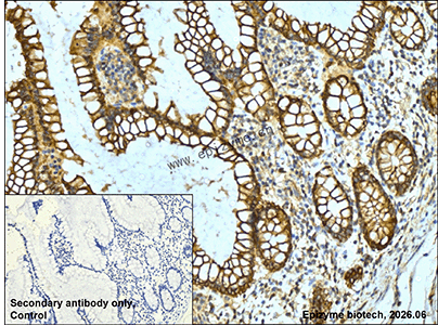 Anti-SEC14L2/TAP Rabbit mAb [77C40R62]