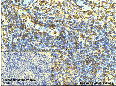 Anti-SEC14L2/TAP Rabbit mAb [77C40R62]