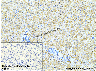 Anti-SEC14L2/TAP Rabbit mAb [77C40R62]