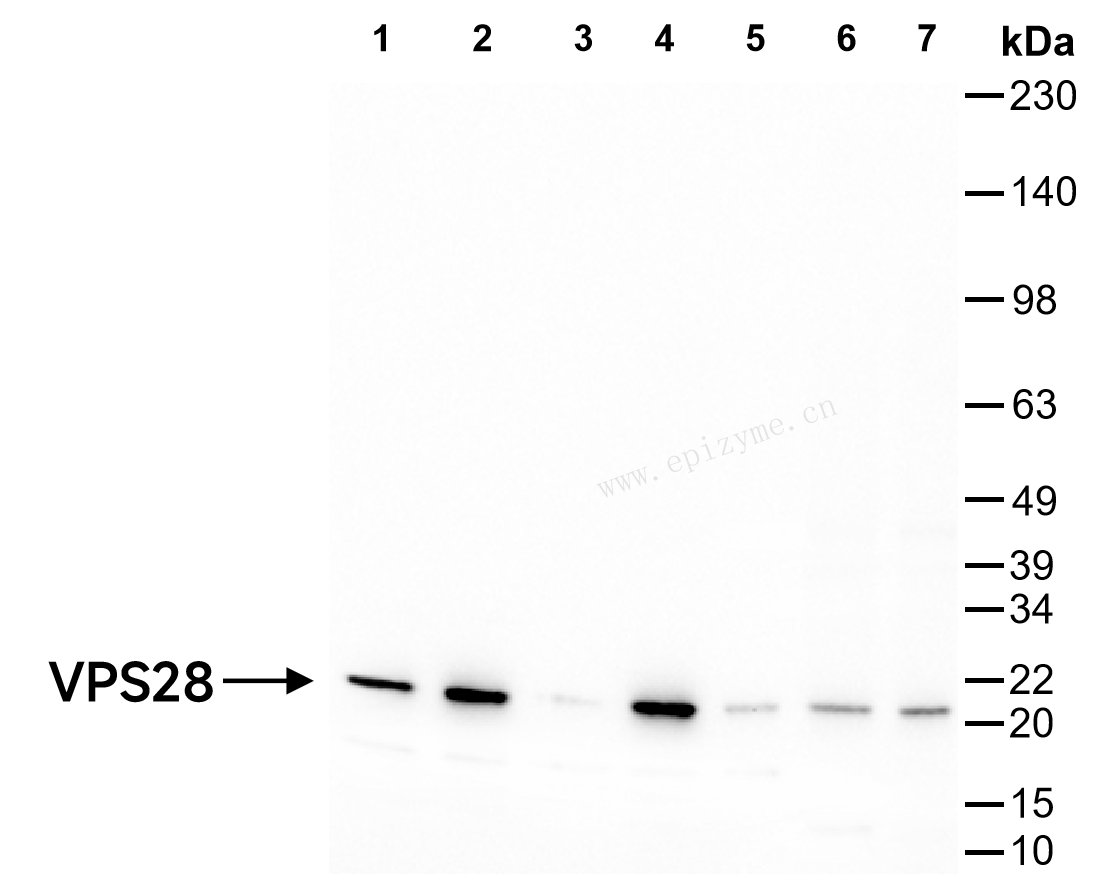 Anti-VPS28 Rabbit mAb [39A35C91]