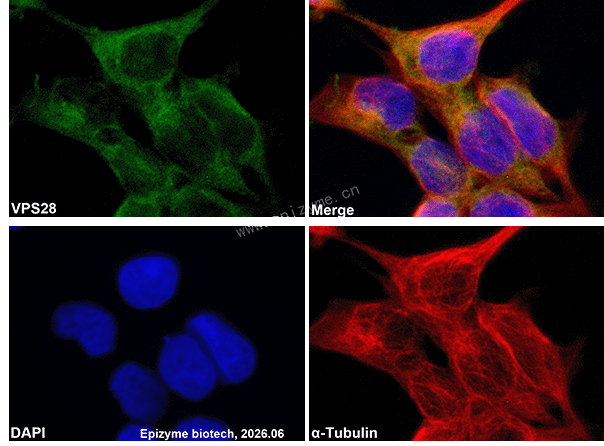 Anti-VPS28 Rabbit mAb [39A35C91]