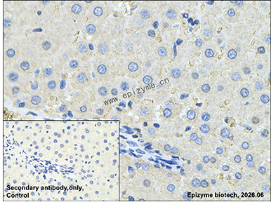 Anti-VPS28 Rabbit mAb [39A35C91]