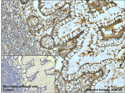 Anti-VPS28 Rabbit mAb [39A35C91]