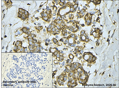 Anti-VPS28 Rabbit mAb [39A35C91]