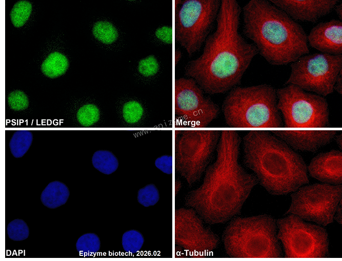 Anti-PSIP1/LEDGF Rabbit mAb [46Q42D76]