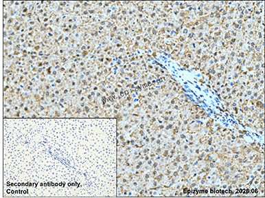 Anti-PSIP1/LEDGF Rabbit mAb [46Q42D76]